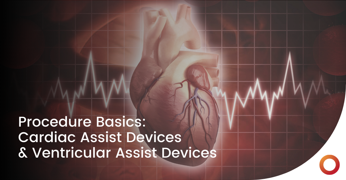 procedure-overview-cardiac-assist-devices-curvo